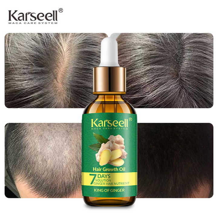 Aceite para el crecimiento del cabello